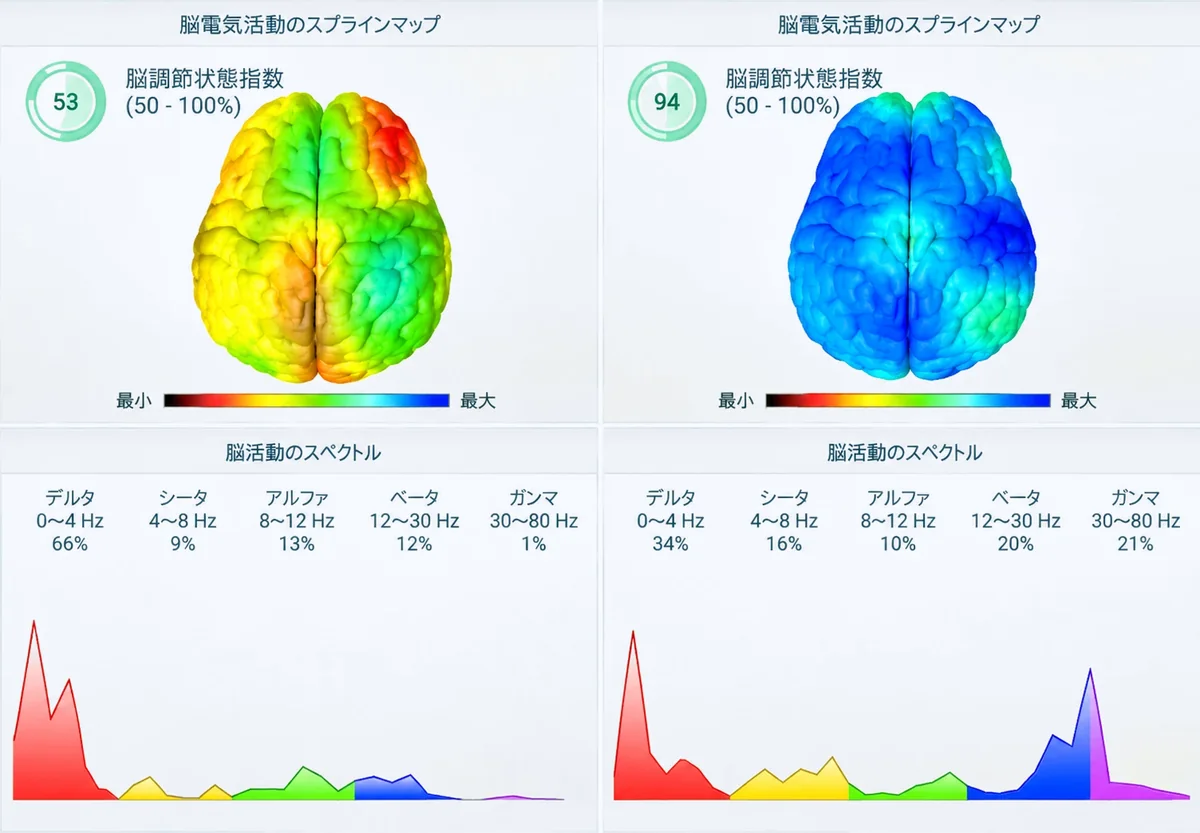 CHI測定レポートの画面例：脳の状態