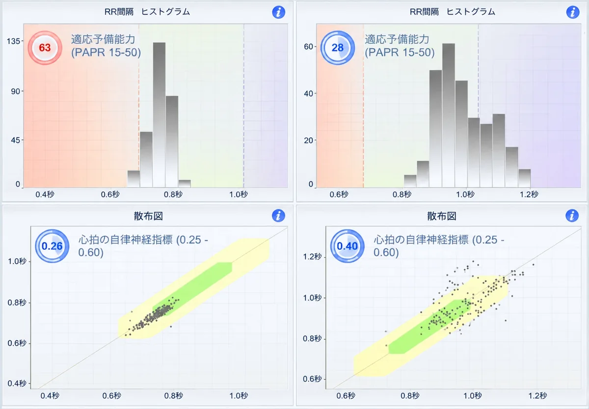 CHI測定レポートの画面例：心拍のリズム