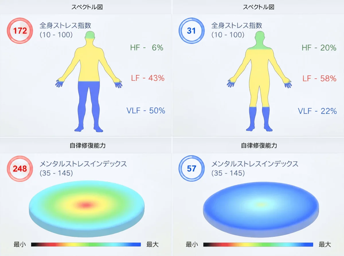 CHI測定レポートの画面例：ストレスの状態